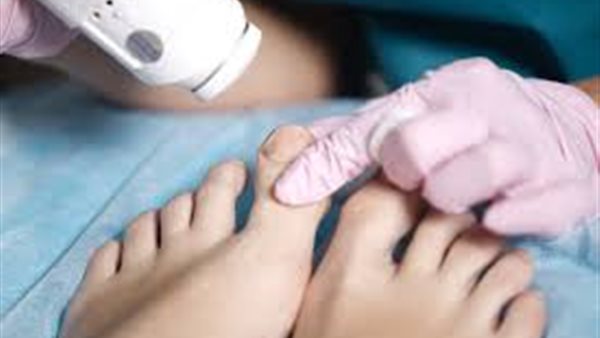 أصابع القدم المنحنية