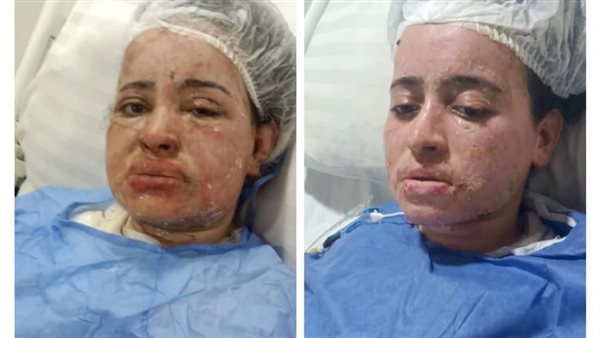 المجني عليها