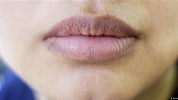 اسمرار الفم