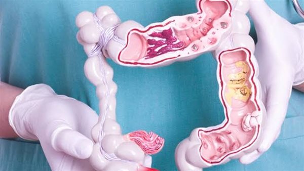 عمليات جراحية-أرشيفية