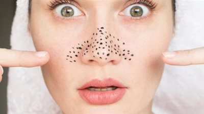 تنظيف البشرة واستخدام لاصقة المسام.. طرق تساعد على التخلص من الرؤوس السوداء 