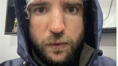 صوّر ستات في الشارع.. تفاصيل أزمة المصور الروسي داخل حي الزبالين | فيديو