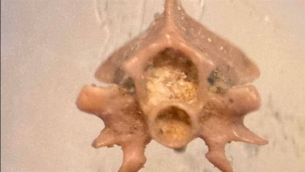 الكشف حفرية لفقرة