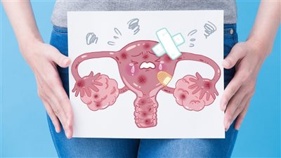 علامات ضعف الخصوبة عند المرأة.. 5 أعراض أساسية انتبهي لها