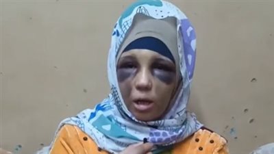 ضحية اعتداء طليقها تستغيث: هددني بتشويه وجهي.. وقال لي هدبح ولادك | بث مباشر