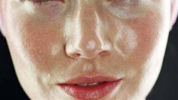 البشرة الدهنية 