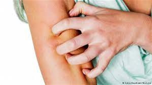 أمراض جلدية 