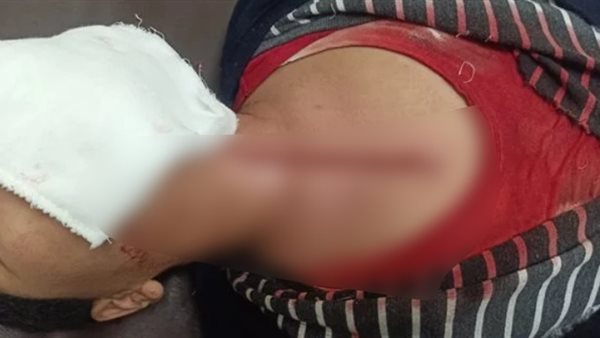 صورة الطالب المصاب