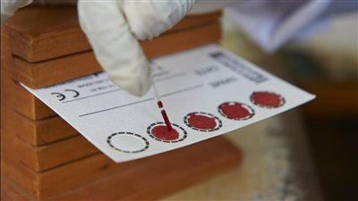 الحكومة توافق على تعديل أسعار الـPCR لـ650 جنيها للمصريين و750 للأجانب