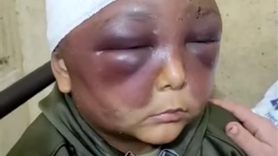 عايز فلوس.. تداول فيديو لطفل عذبه والده في الدقهلية لرفضه التسول | فيديو