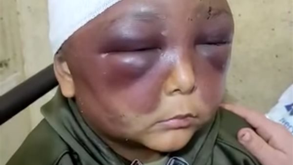 الطفل المجني عليه