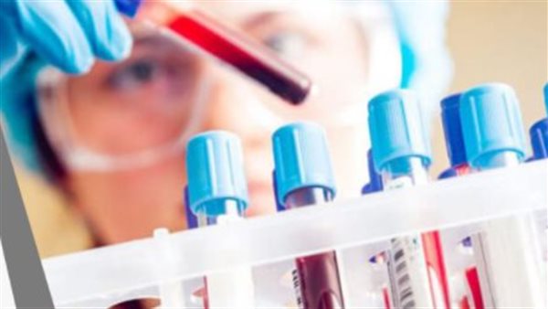 تحاليل طبية 