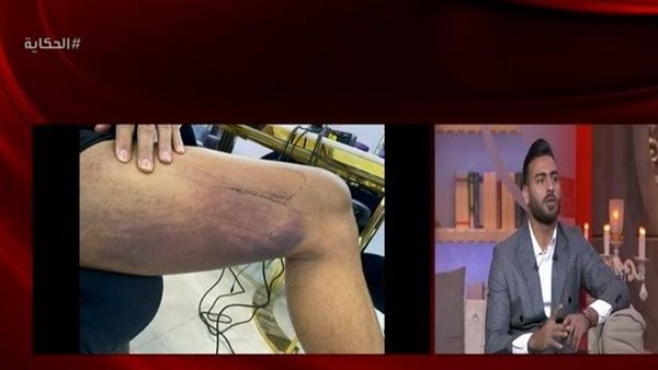 إصابة محمد أبو جبل