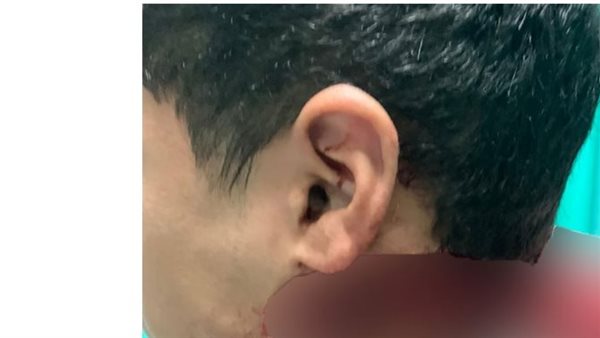 الطالب المصاب 