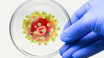 بريطانيا تعلن وفاة أول حالة بحمى لاسا المعدية 