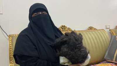 بعد حبس المتهمين.. والدة طفلة أصيبت بصلع خلال جلسة تصفيف: الحكم مرضي وبعتذر لـ بنتي