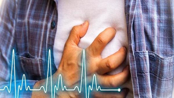 سكتة قلبية - تعبيرية