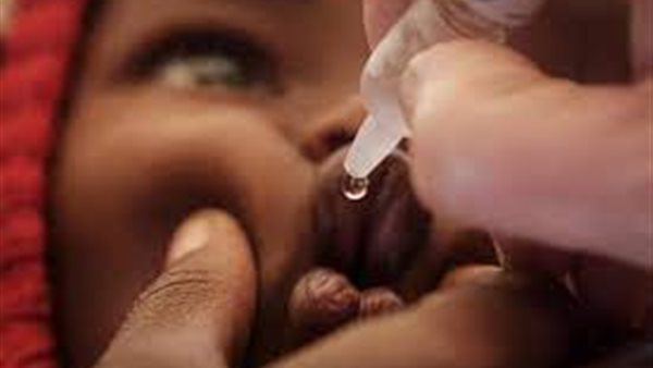 شلل الأطفال