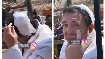 إصابة جميل المغازي أثناء تصويره كليب لـ شمس الكويتية