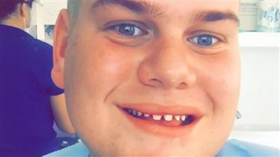 بتكلفة 25 ألف إسترليني.. بريطاني يجري جراحات تجميلية لتقليد الأشخاص على انستجرام