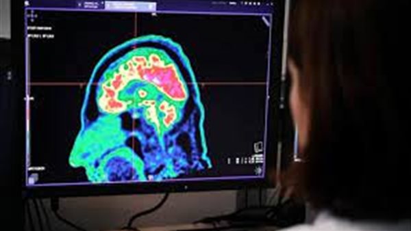 نشاط الدماغ