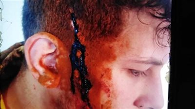 يعملوها الكبار ويقعوا فيها الصغار.. شجار داخل قريتين دفع ثمنه طلاب مدرسة بالشرقية واستغاثات من أولياء الأمور