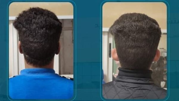 إصلاح الشكل الخارجي