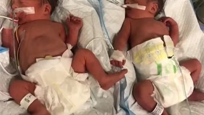 مأساة من الحرب الروسية الأوكرانية.. زوجان أمريكيان يفشلان في إخراج رضيعتيهما من مستشفى في كييف