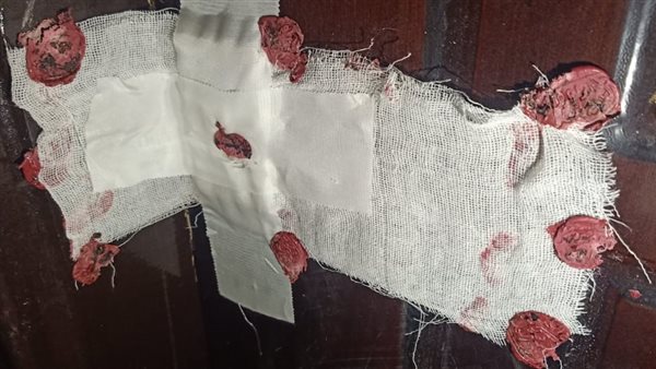 صحة الغربية: غلق