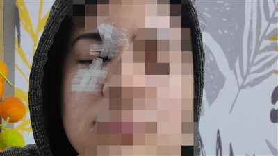 إصابات بالوجه واليدين.. ضبط الشاب المعتدي على فتاة بسلاح أبيض في شبرا الخيمة