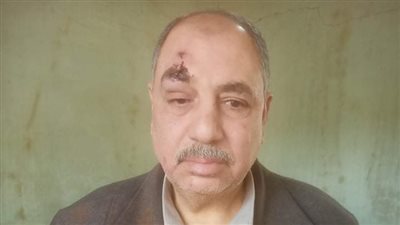 ولي أمر يقتحم مدرسة بشبين القناطر ويصيب مدرسًا بعكاز في رأسه | صور