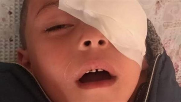 الطفل أشرف ضحية معلمة