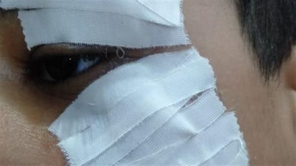 إصابة تلميذ 