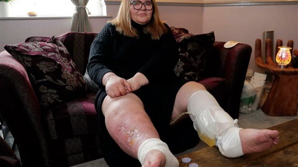 السيدة فيرن وولمالد