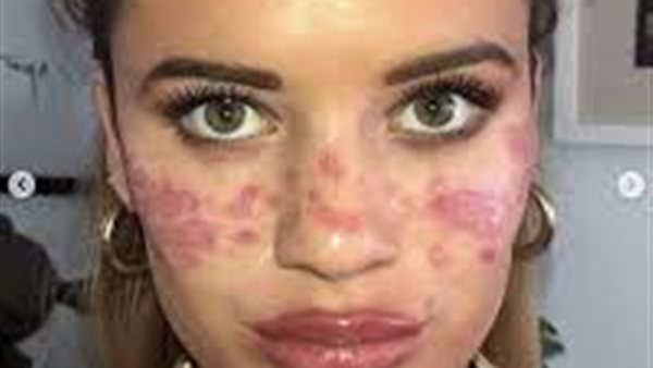  تيلي ويتفيلد