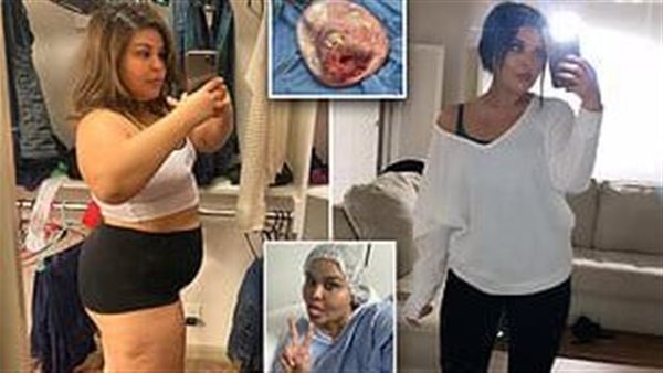 الفتاة المريضة 