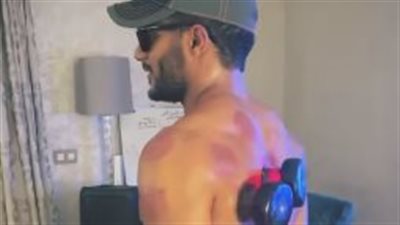 محمد رمضان بعد خضوعه لتجربة الحجامة: اللهم أَدِمْ علينا الصحة والعافية