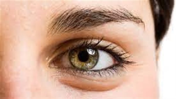 انتفاخ العين