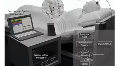 أول طلباته تناول البيرة.. مشلول يتواصل مع عائلته لأول مرة منذ سنوات بعد عملية زرع دماغ