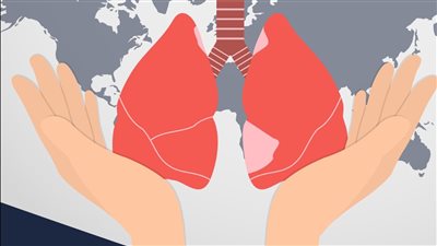 هيئة الدواء تقدم مجموعة من النصائح الخاصة بالتعامل مع أدوية الدرن