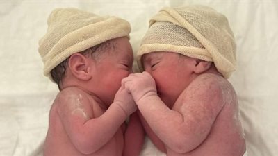 يحدث نادرا.. ولادة توأم داخل كيس ألمنيوسي سليم