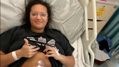 بحجم كرة القدم.. استئصال ورم من معدة فتاة ظنت أنه انتفاخ من الإفراط في الطعام