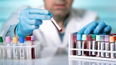 بعد واقعة تضارب نتيجة التحاليل.. بنك البركة يوقف التعاملات مع معامل ألفا (مستندات)