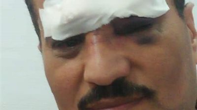 بعد رشق صبيه كابينة القيادة.. “السكة الحديد” تعلن إصابة سائق قطار المنصورة