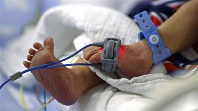 أم تضع 3 أطفال بمستشفى أرمنت التخصصي.. وحالتها مستقرة