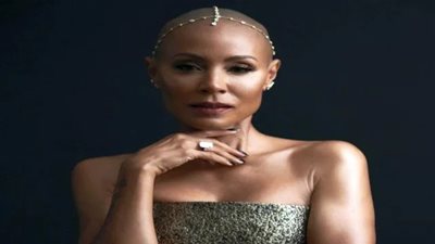 بعدما تسبب في صفع كريس روك.. ما مرض الثعلبة المصابة به زوجه ويل سميث؟