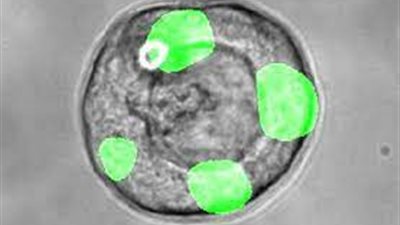 باحثون يكتشفون نوعًا جديدًا من الخلايا في الرئة البشرية بخصائص تجديدية