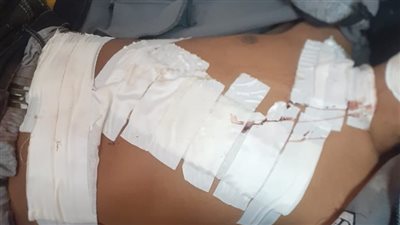  200 غرزة بالوجه.. صبي يدفع ضريبة اتهام والده بسرقة جيرانه في السلام | فيديو