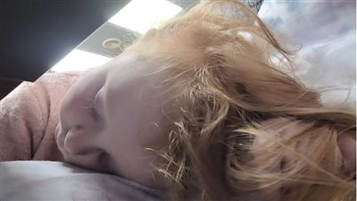 ارتفعت حرارتها لأكثر من 39 درجة.. وفاة طفلة بريطانية بعد تناولها بيضة كيندر