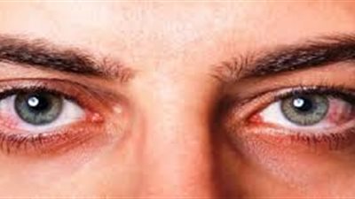 اعتلال الشبكية السكري.. تعرف على الأعراض والأسباب